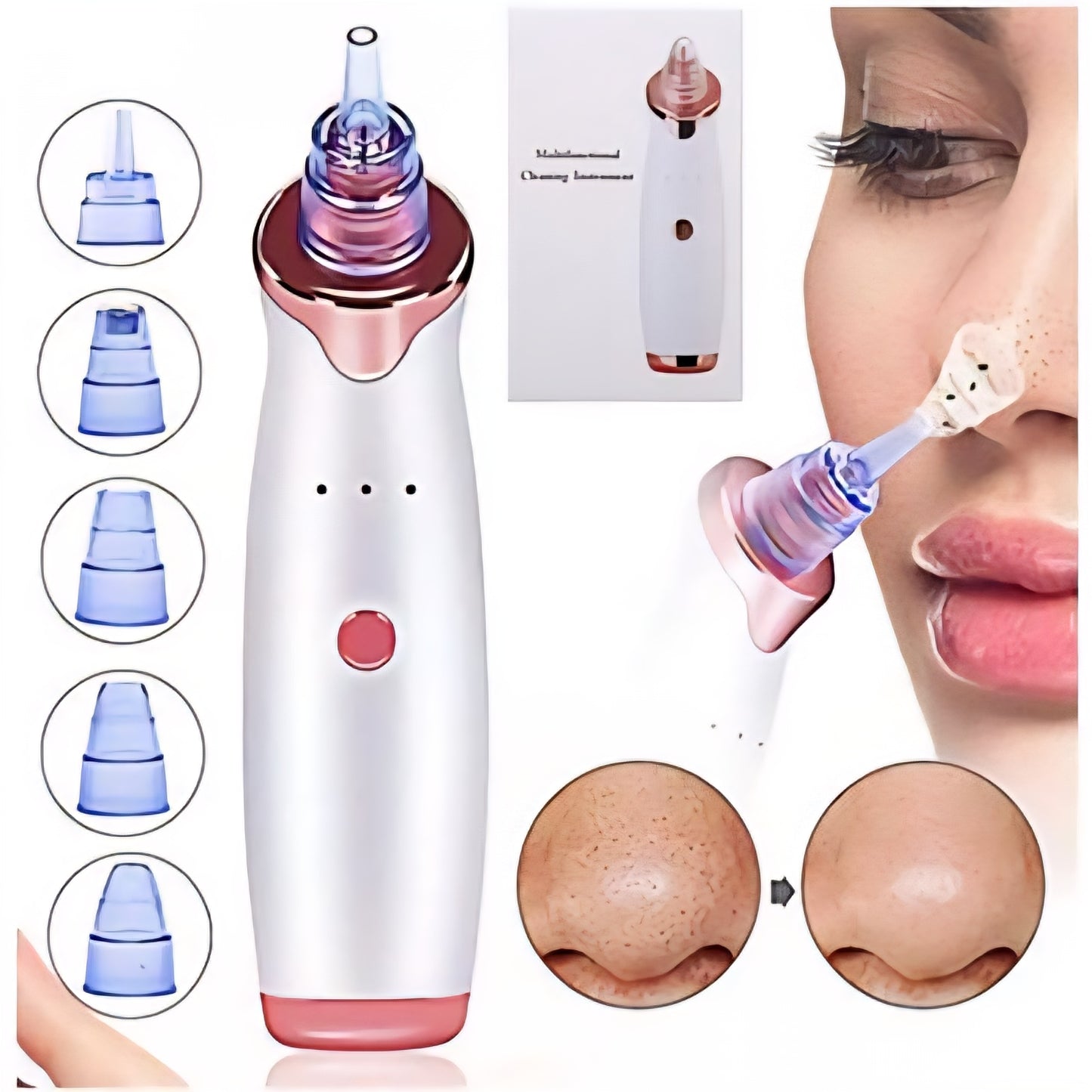 Aspirateur électrique pour soin de visage (Graisse, points noirs...)